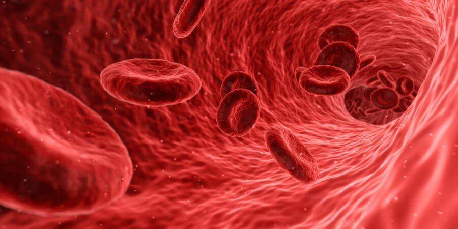 Demência Vascular o que é e como evitar